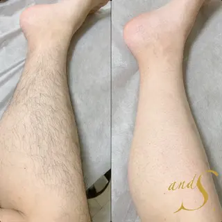 メンズ 🌸🧡六本木 脱毛しずか🧡🫧の眉毛・アイブロウイメージ