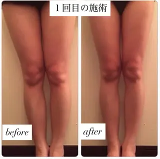 private salon Rions所属・育乳/整体/痩身 サロンRIONSのエステ・リラクイメージ