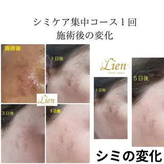 Lien オーナー 山口智嘉のエステ・リラクイメージ