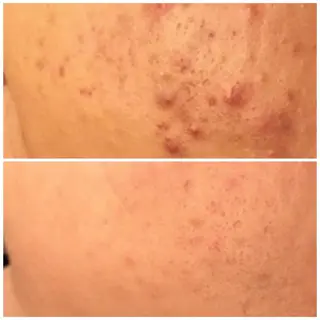 触れたくなる モテ肌へ...❤︎のエステ・リラクイメージ