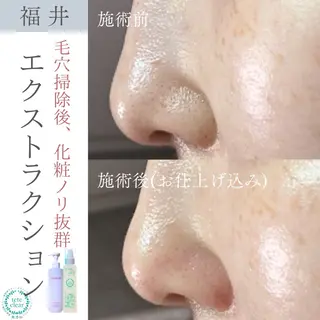 毛穴ケア専門サロン Yourmeユアミーのエステ・リラクイメージ