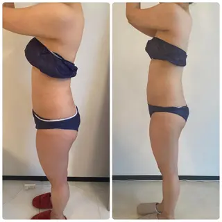 FLEUR大阪・美容 整体・痩身・小顔のエステ・リラクイメージ