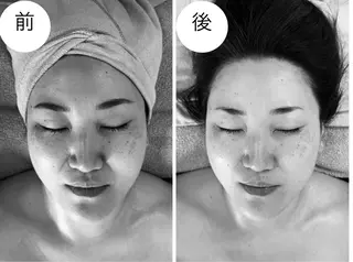 MiEL  total beaty salon所属・肌質改善サロン ナツコのエステ・リラクイメージ