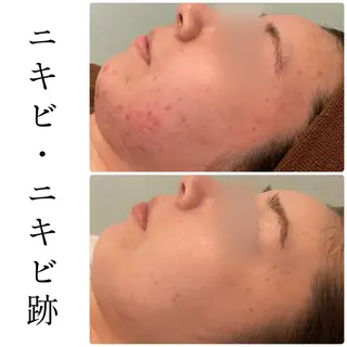 ハーブピーリング専門 BIOEL横浜のエステ・リラクイメージ