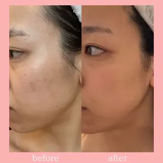 Luuna高岳 🌼hikaruの眉毛・アイブロウイメージ