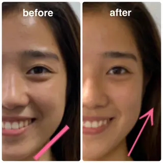 小顔美肌&痩身ｻﾛﾝ My Timeのエステ・リラクイメージ