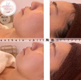アンテインチル 山本のエステ・リラクイメージ
