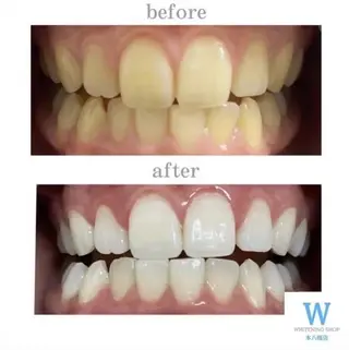 ホワイトニング ショップ本八幡店のエステ・リラクイメージ