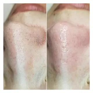 U_la所属・U_la [ウーラ] 片岡の眉毛・アイブロウイメージ