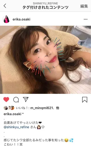 鍼灸整骨院Refine所属・鍼灸 Refineのその他イメージ