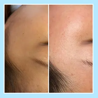 L’oeillet所属・🌊🌊__ juna__のマツエク・マツパデザイン