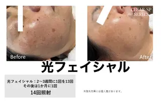 Salon Cherie所属・ナカヤマ リカのエステ・リラクイメージ