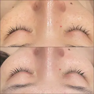 LiZA エステティックサロンのエステ・リラクイメージ