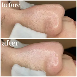 韓国肌管理 【毛穴専科】のエステ・リラクイメージ