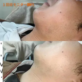 メンズ 武 藤のエステ・リラクイメージ