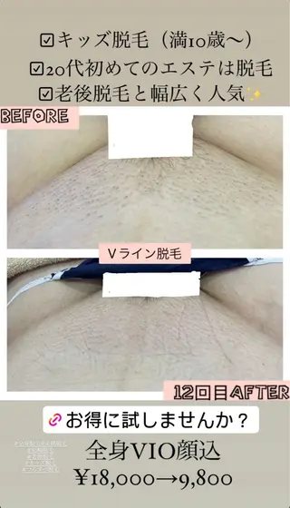 ブライダル痩身×脱毛 尼崎駅前サロンのエステ・リラクイメージ