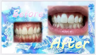 セルフホワイトニングサロン　ラヴィアン所属・ホワイトニングサロン La vie enのその他イメージ