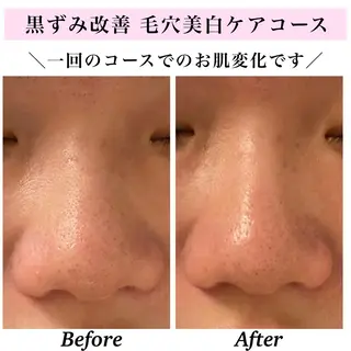 Bellesthe (ベルエステ)のエステ・リラクイメージ