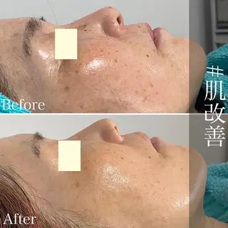 メンズ歓迎🙆‍♀️ エステ/ネイルISTのエステ・リラクイメージ