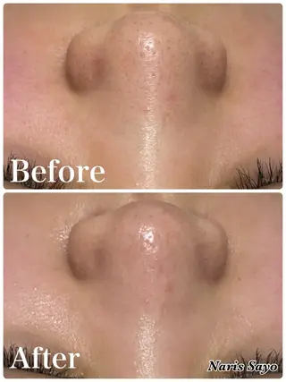 デ・アイム豊中所属・朝山 紗世子のエステ・リラクイメージ