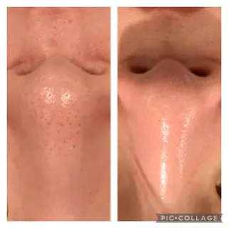 ♡RAYVIS♡ 名古屋店　神田のエステ・リラクイメージ