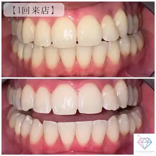 💎ダイヤモンド ホワイトニング渋谷のその他イメージ