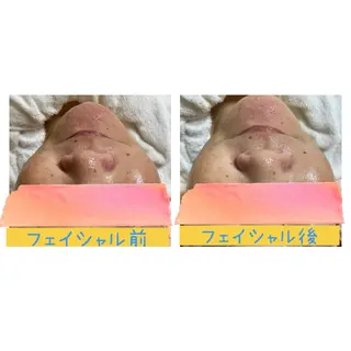 癒し×小顔×毛穴ケア サロンSourilのエステ・リラクイメージ