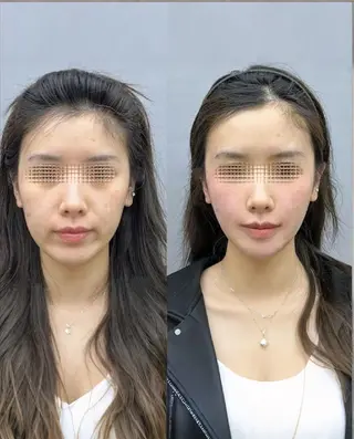 マツエク・マツパ aliaハイフ&水光ジェットサロン所属・aliaハーブ水光店 エステティシャン募集のエステ・リラクイメージ