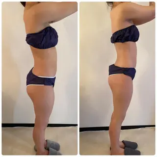 FLEUR大阪・整体 ・ハイフ・痩身・小顔のエステ・リラクイメージ