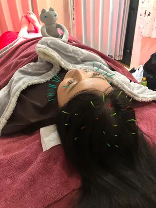 美容鍼灸女性専用 りんご鍼灸治療院のその他イメージ