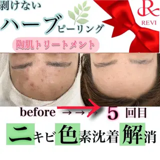 laluna saki...のその他イメージ