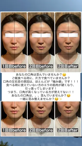 💎後悔させない小顔 矯正💎イトヤマ🌱のエステ・リラクイメージ