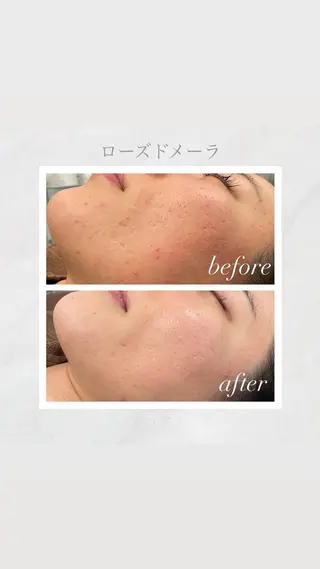 🦋美肌サロン. maho🦋のエステ・リラクイメージ