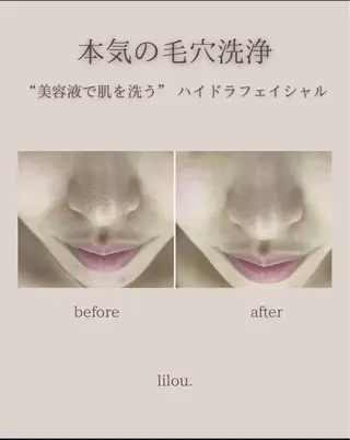 吉田 lilou.のエステ・リラクイメージ