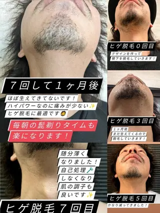 プライベートサロン宿り木所属・江坂@宿り木　脱毛＆ 耳ツボジュエリーのその他イメージ