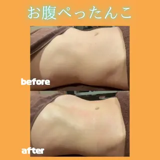 痩身&美肌サロン ビュースタ 伊藤🌷のエステ・リラクイメージ
