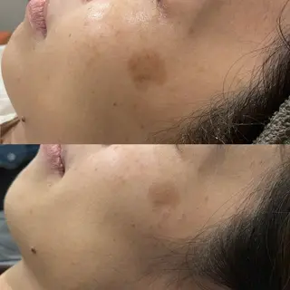 LiZA エステティックサロンのエステ・リラクイメージ