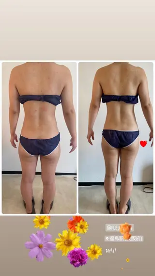 FLEUR大阪・整体 ・ハイフ・痩身・小顔のエステ・リラクイメージ