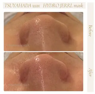 艶肌ワックス ALLY.のエステ・リラクイメージ