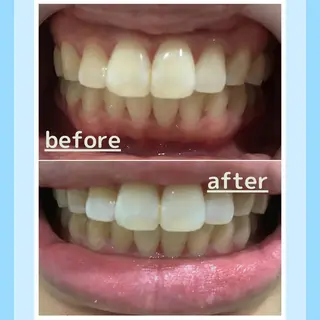 メンズ お手軽ホワイトニングsalon mina所属・武元 奈津美のその他イメージ