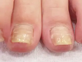 ネイル y.所属・y. salonのマツエク・マツパデザイン