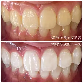 PLATINUM Beauty 横浜店所属・ホワイトニングルーム 横浜店のその他イメージ