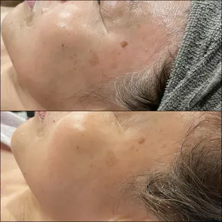 LiZA エステティックサロンのエステ・リラクイメージ