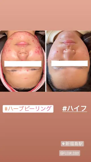 FLEUR大阪・整体 ・ハイフ・痩身・小顔のエステ・リラクイメージ