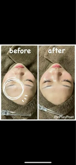 🍀fleur🍀 杉浦のエステ・リラクイメージ