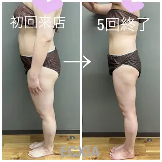 ECXIA 【エクシア】のエステ・リラクイメージ