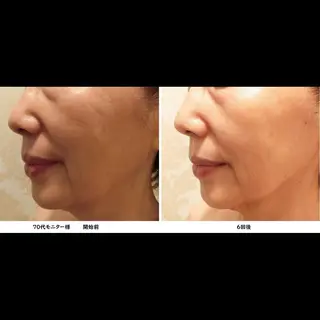 くびれ作り専門サロン こねこのシッポ虎ノ門のエステ・リラクイメージ