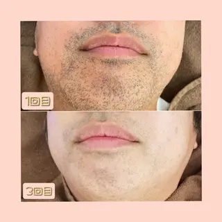 salonde ReGodのエステ・リラクイメージ