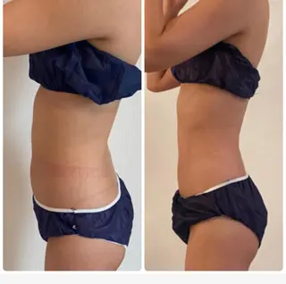 FLEUR大阪・整体 ・ハイフ・痩身・小顔のエステ・リラクイメージ