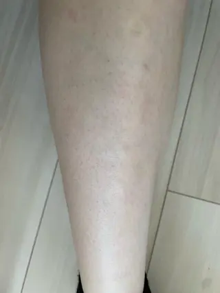 メンズ キッズ 脱毛SALON RaYNiCKのエステ・リラクイメージ